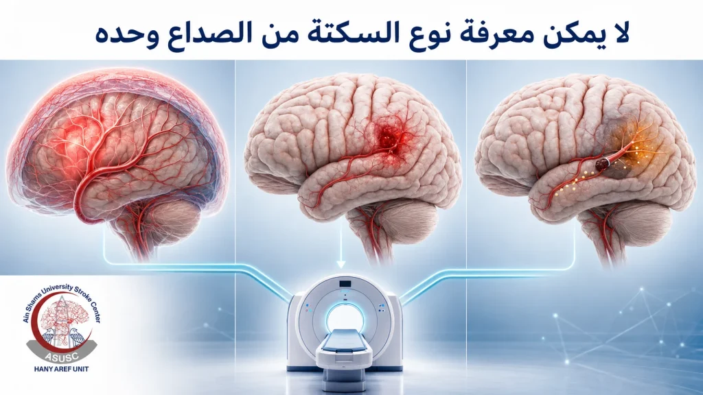 مقارنة بين السكتة الإقفارية والنزف داخل المخ والنزف تحت العنكبوتية