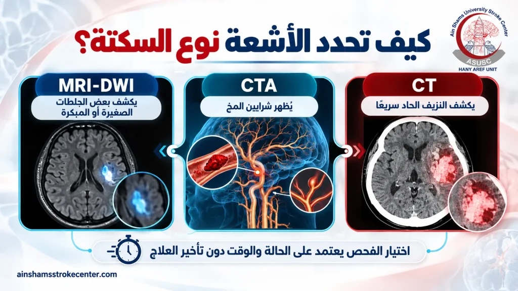 دور الأشعة المقطعية وتصوير الشرايين والرنين في تشخيص السكتة الدماغية